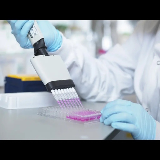 [AE24192BO] Bovine Alpha fetoprotein (AFP) ELISA Kit