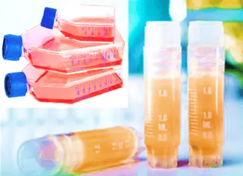 [CELL-SK-770] Human Adrenal Fibroblasts